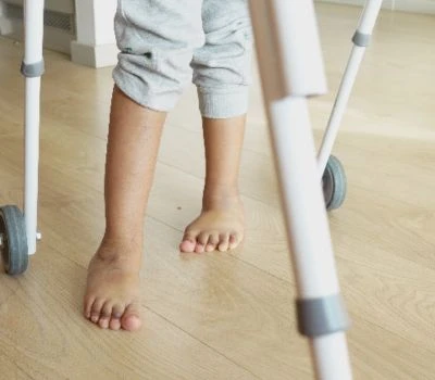 Nesoulad v délce nohou: Pochopení nerovnováhy, rozpoznání poškození a nalezení jasnosti pomocí 3D...